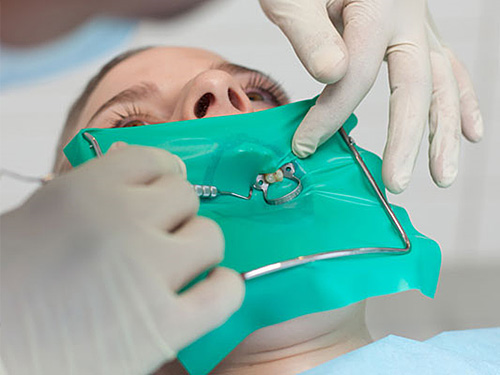Tratament Endodontic
